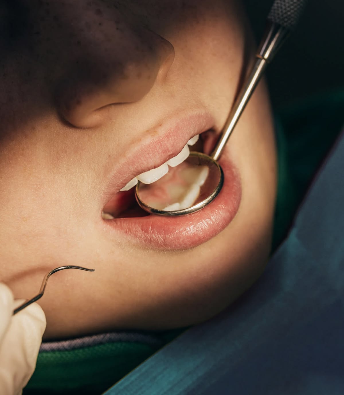 Child receiving a dental examination