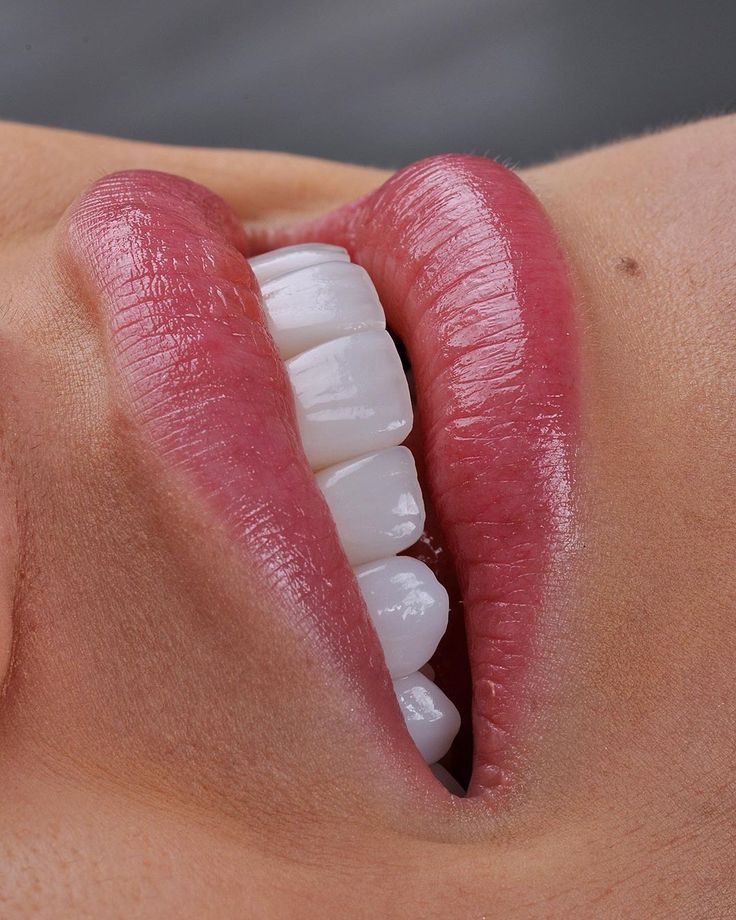 Close-up of a smile with white teeth